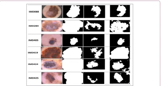 Figure 2: Melanoma detection for proposed method compared with ASLM method.