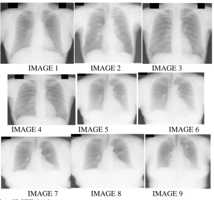 Fig. 3: Input images (after, JRSET database) 