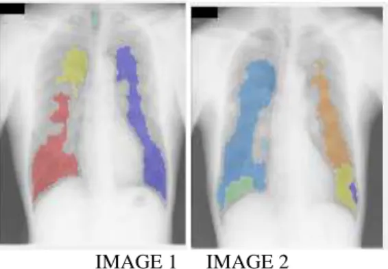 Fig. 10: Result of watershed algorithm 