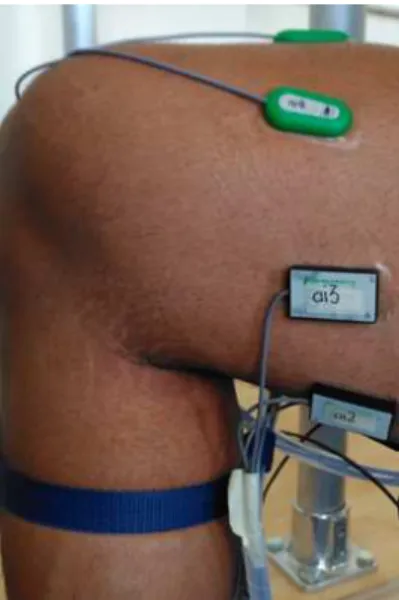 Fig. 1. Electrode placements along the thigh circumference.