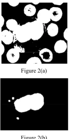Table 1: Normal Blood Count Differentiate by Gender 