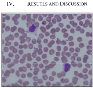 Figure 5: a) Segmented WBC nucleus b) RBC 