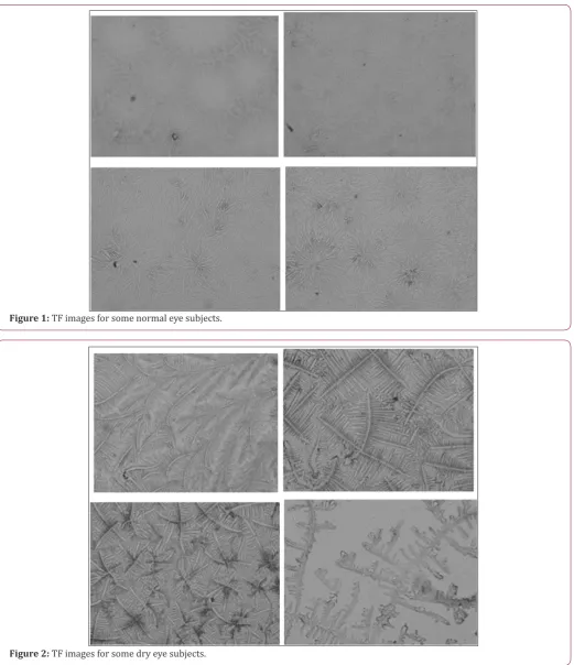 Figure 1: TF images for some normal eye subjects.
