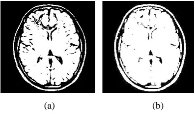 Fig 4. (a) Original Image (b) Eroded image 