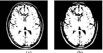 Fig 6. (a) Original Image (b) By closing 