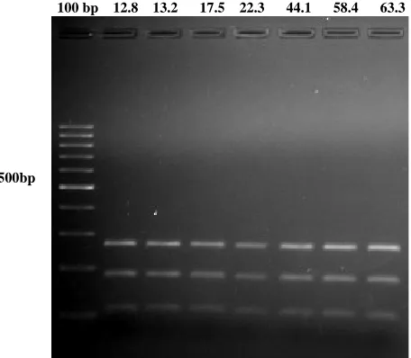 Figure 5. Sample gel showing amplification products of the Ramularia areola isolates using restriction enzyme Hinf I