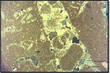 Fig. (3): Photomicrograph shows Bio-Sparite represented by fossil tests and shell fragments