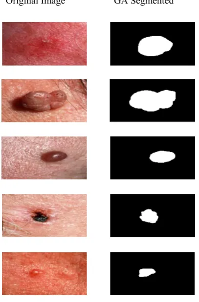 Figure 6 Comparison of different segmentation algorithms   The above figure shows the graph that compares various 