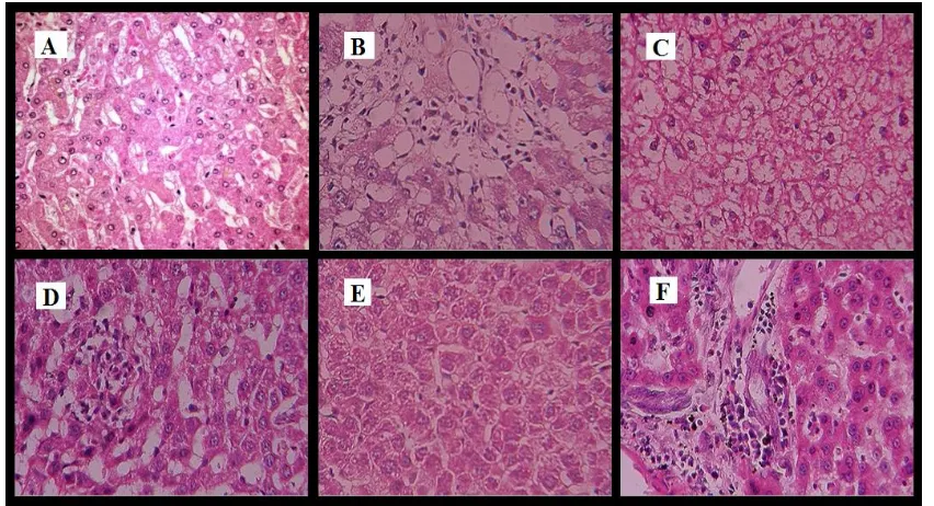 Fig. No.4- Liver architectures in Curative study (ETH induced liver damage): (A) normal  control [ 2% Gum acacia]; (B) toxic control [ETH (3.7g/kg; p.o)]; (C) ETH + AEAS (3.7g/kg; p.o + 100mg/kg); (D) ETH + AEAS (3.7g/kg; p.o + 200mg/kg); (E) ETH + AEAS (3.7g/kg; p.o + 400mg/kg); (F) ETH + Silymarin (3.7g/kg; p.o + 100mg/kg) 