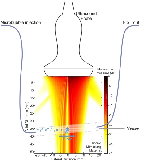 Fig. 1.Illustration of the ultrasonic trap with an asymmetrical pressure ﬁeld.Trapping region is located along 0 mm lateral axis.