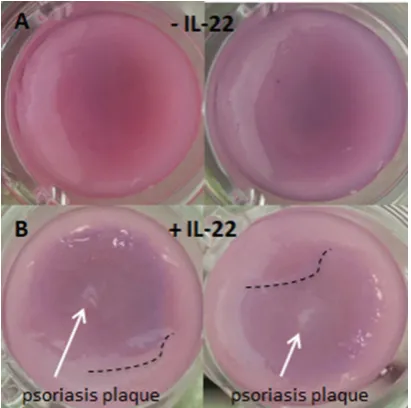 Figure 2. Labskin stained with AlamarBlueWithout treatment with IL-22 there are no visible changes to theepidermis of the LSEs