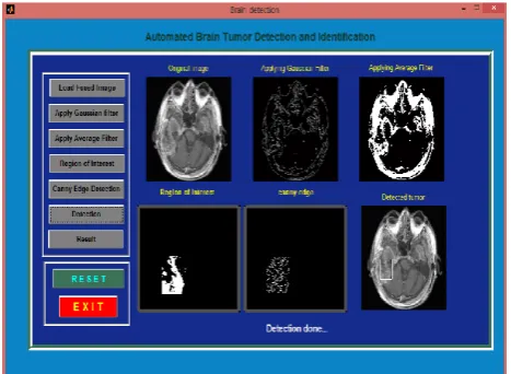 Figure 3: Implementation of Image Fusion 