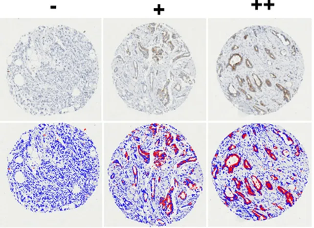 Figure 5: Migration of IGFBP knockdown cells plotted as relative wound density (RWD) v time