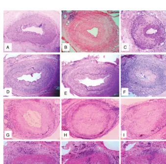 FIGURE 2. (A–C) Additional histological patterns observed in temporal artery biopsies from patients with giant cell arteritis (GCA).Normal temporal artery section (A)