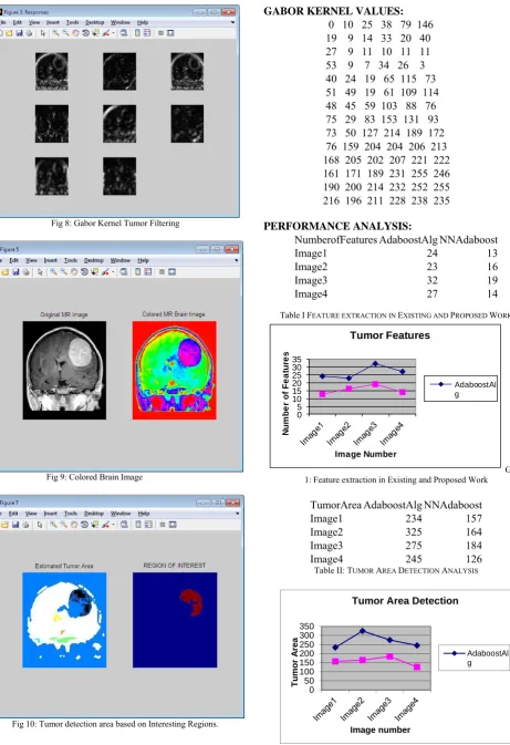 Fig 10: Tumor detection area based on Interesting Regions. 