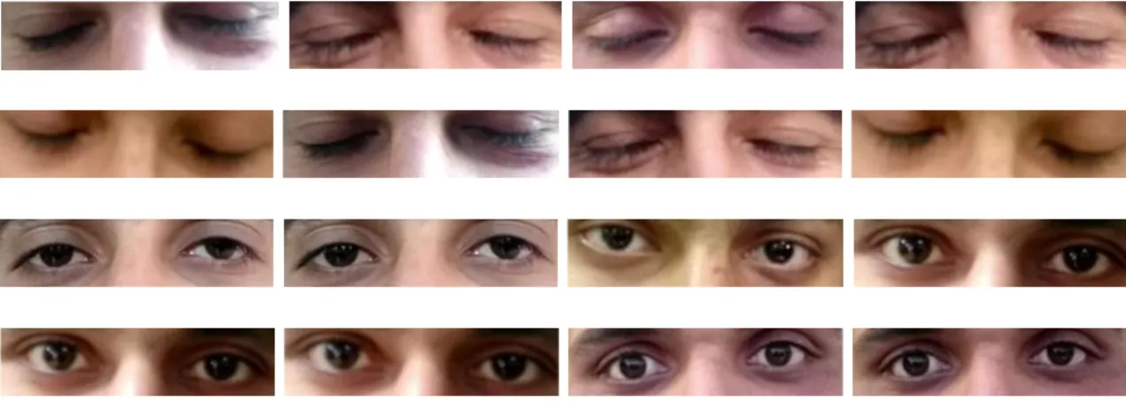 Figure 4.4 shows few sample images used for eye blink detection algorithm.