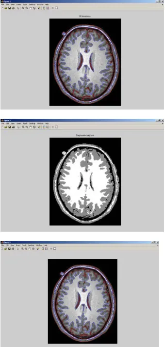Fig 2 Steps employed for Image segmentation of Intensity Homogeneity based on level set method  