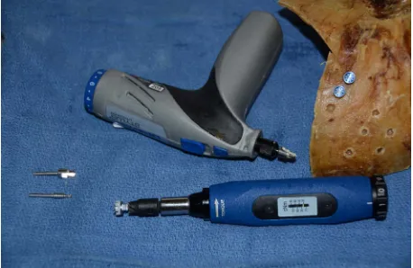 Table 3When the temperature probe was applied to the bone, the 