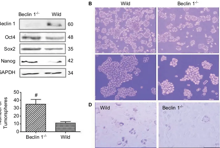 Figure 6 Beclin 1 is critical for maintaining the proliferation of breast cancer stem cells (cscs) and progenitor cells