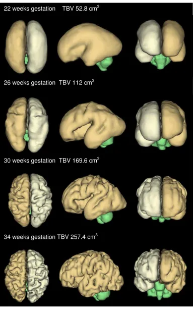 Figure 5. 3D reconstructions of fetal brains with corresponding volume measurements at four 