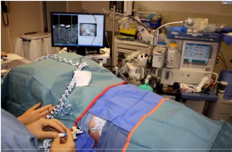 Figure 3. The user is advancing the ablation probe into the liver based on the navigation information