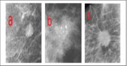 Fig. 2: Types of abnormalities. 
