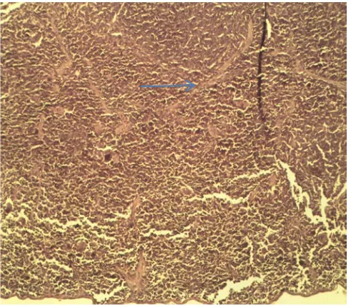 Figure 2:  Group 1, showed  hemorrhage, (        