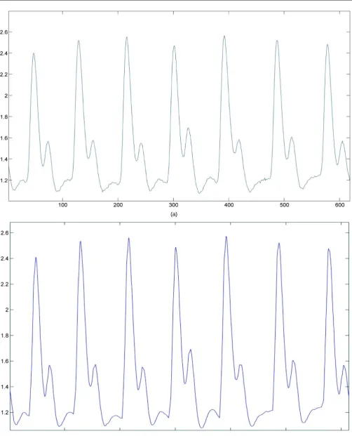 Figure 4. (a) The noisy pulse waveform; (b) The denoising pulse waveform. 