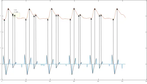 Figure 6. Characteristic points of pulse wave. 