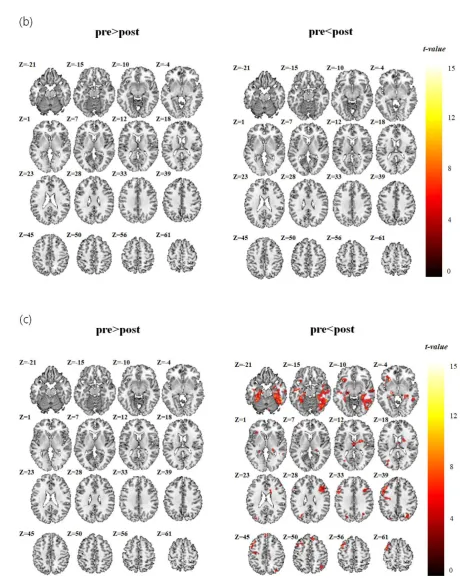 Figure 4.Brain activation maps for paired t-test analysis (p<0.05, with FWE correction using Monte Carlo simulation by 3dClusSim and a minimum cluster size of 163)