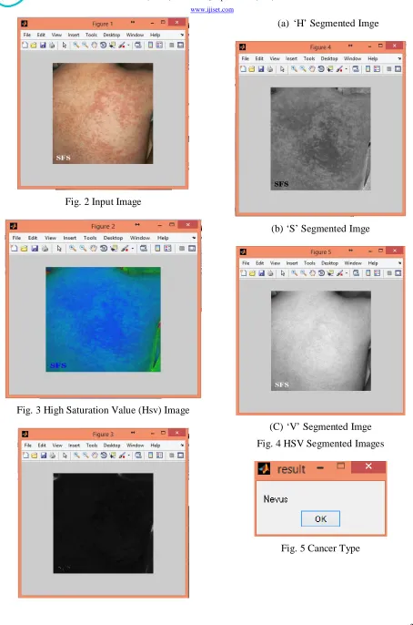Fig. 2 Input Image 