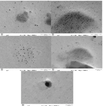 Fig. 4: TEM images of the prepared V 2 O 5  sample at different magnifications. 