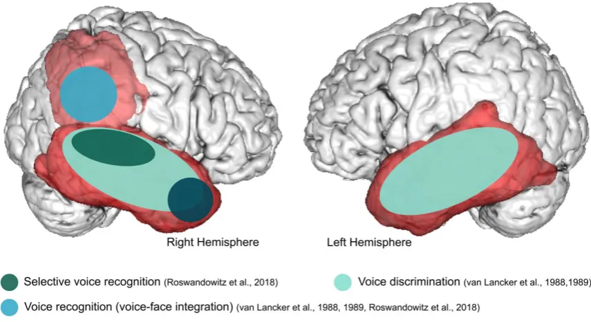 Figure 2. Schematic overview of studies reporting lesion locations associated with the respective voice- identity processing and multi-modal person recognition deficit