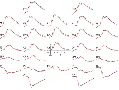 Figure 4. Consistency effect of the 2 studies grouped. Grand (n=64) averages of the ERPs of the 32 