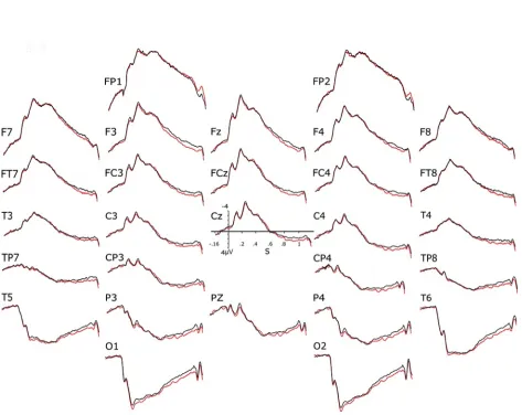 Figure 5. Grand averages of the ERPs of the 34 strangers of the second experiment. The black lines 