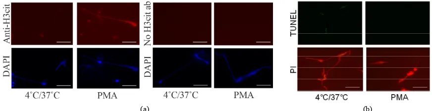 Figure 3. Hypothermia/rewarming-induced DAPI-positive, NET-like structures exhibited several features distinct from 