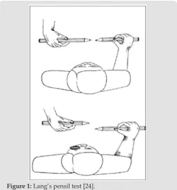 Figure 1: Lang’s pensil test [24].