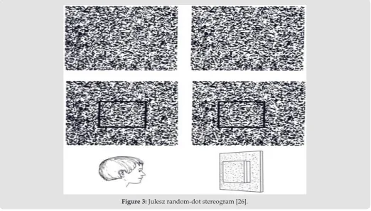 Figure 2: Synoptophore[25].