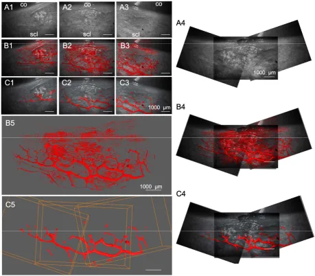 Figure 3: Rendering and alignment of adjacent outflow tract vessel volumes in 3D 