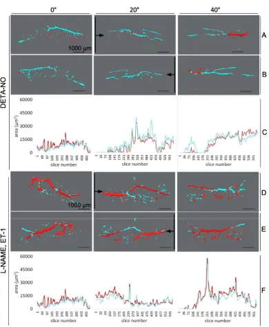 Figure 4: Quantification of cross-sectional area pre-and post-treatment 