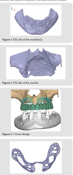 Figure 1: STL file of the mandibula.