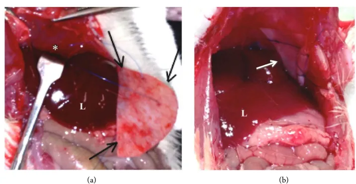Figure 1. (a) shows BP patch® (black arrows) as it is sutured on the diaphragm (*) and (b) shows Gore-Tex® (white arrow) already sutured on the diaphragm