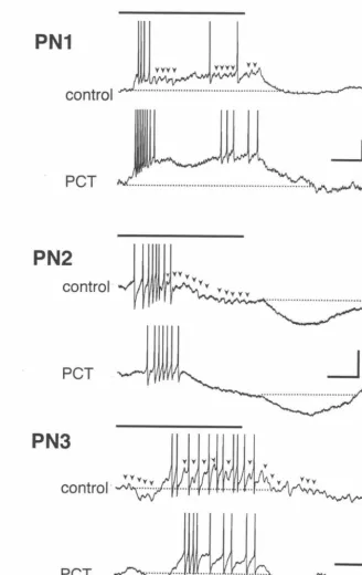 Figure 4. IPSPs evident in control responses are absent (or greatly diminished and non-rhythmic) in PCT