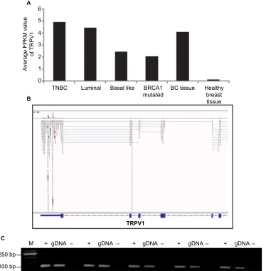 Figure 3 Expression of TRPV1 in breast cancer tissues and cell lines.Notes: (A) Comparison of expression of TRPV1 in all breast cancer subtypes investigated