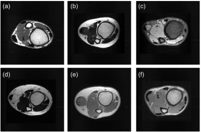 FIG. 2. Examples of different subjects and different MRI sequences used in the experiments