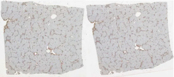 Figure 3 Sequential liver microscopy image registration. (Left): a microscopy image of a liver