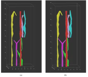 Figure 7 3D visualization result of (a) machine-identiﬁed and (b) human-annotated vessels.