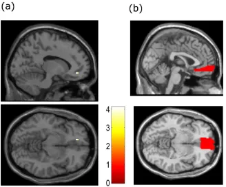 Figure 5. shown at p Efects of item familiarity. Efects of the familiarity of the item at the time of the event (a), Plots < 0.05 FWE, SVC on the vmPFC mask in (b).