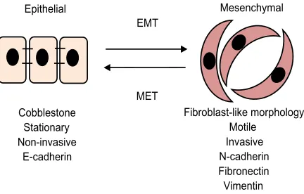 Figure 2 Schematic outline of breast cancer progression.Notes: To begin the process of metastasis a malignant cell must migrate away from the primary tumor; this requires the degradation of the basement membrane