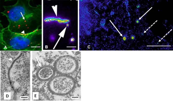 Figure 1. Localization of gap junction plaques and annular gap junction vesicles. A) Immunocytochemistry of Cx43 (red) and cortical actin (green)
